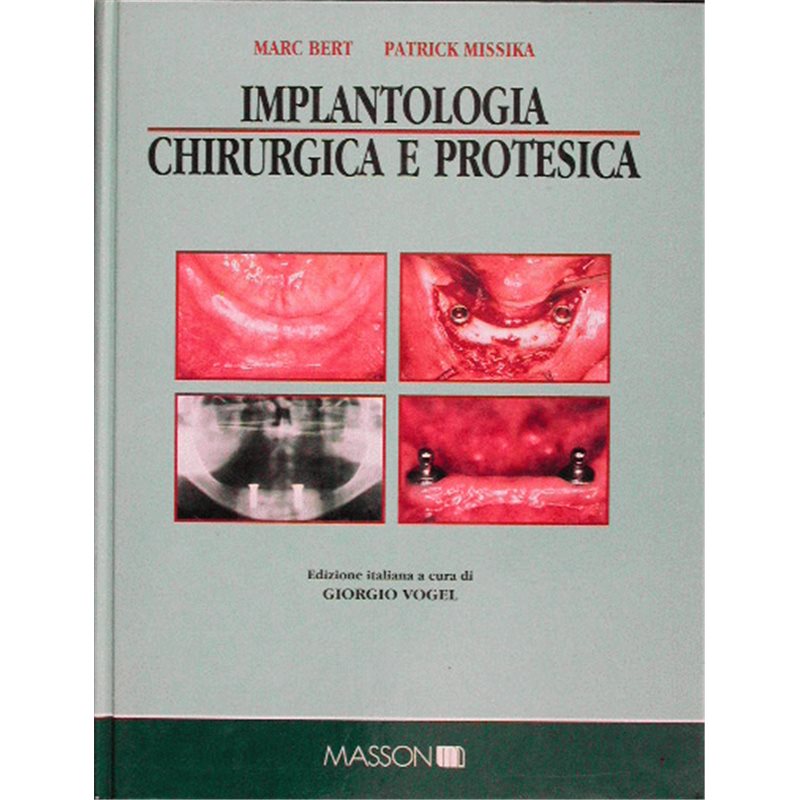 Implantologia chirurgica e protesica